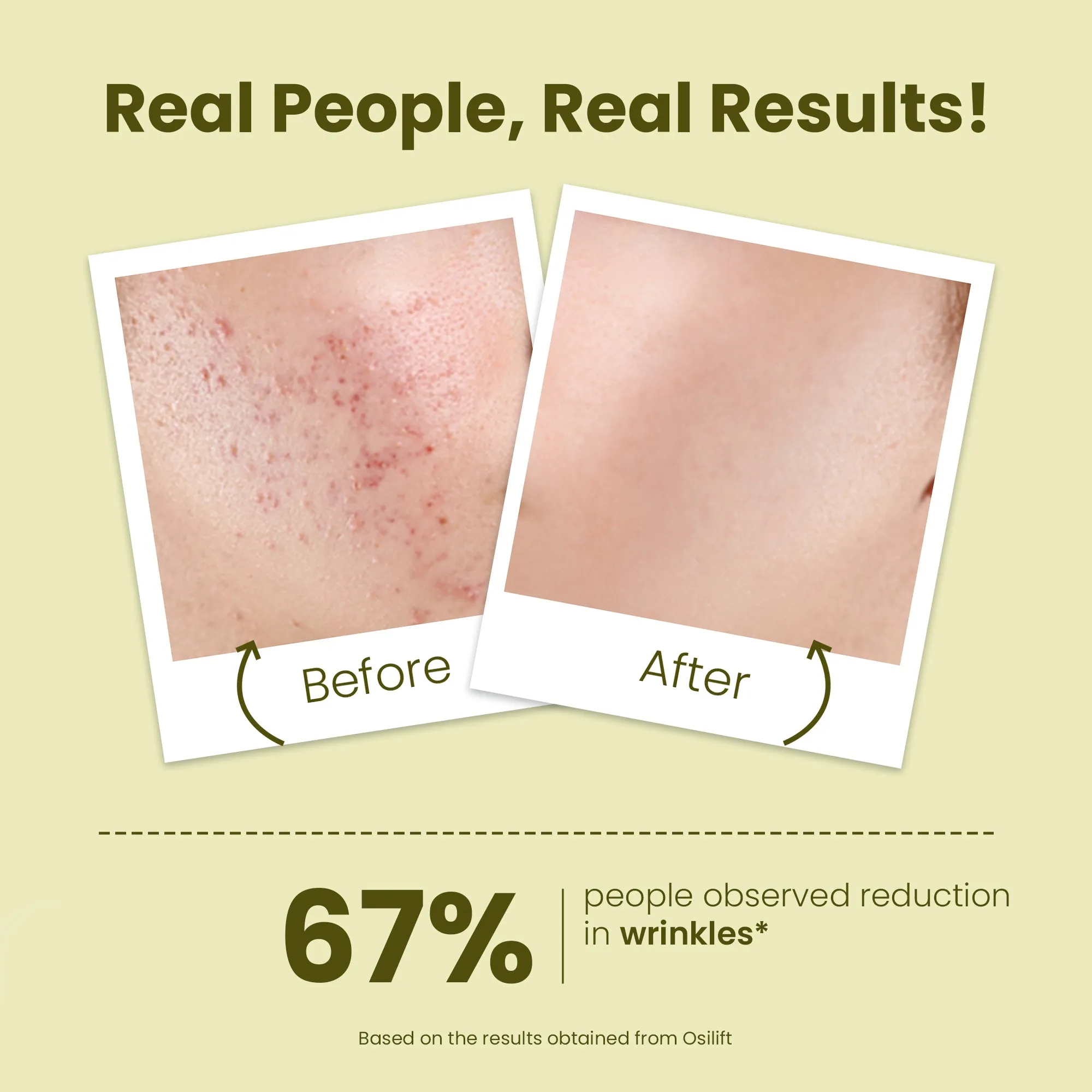 Anti-wrinkle Young Forever Face Serum